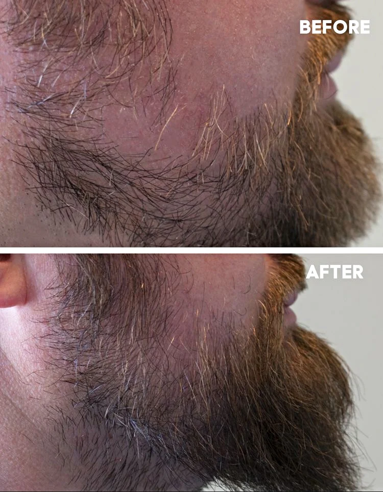Hår og Skjegg Serum 100ml - Image 7